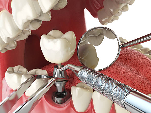 Best Urgent Care for Lost Fillings or Crowns in Tennille, GA